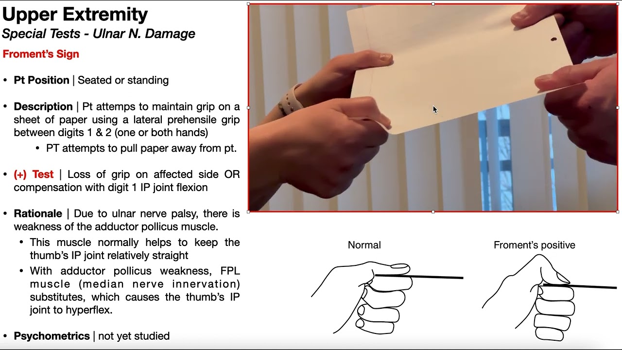 Froment's Sign | Rationale & Interpretation