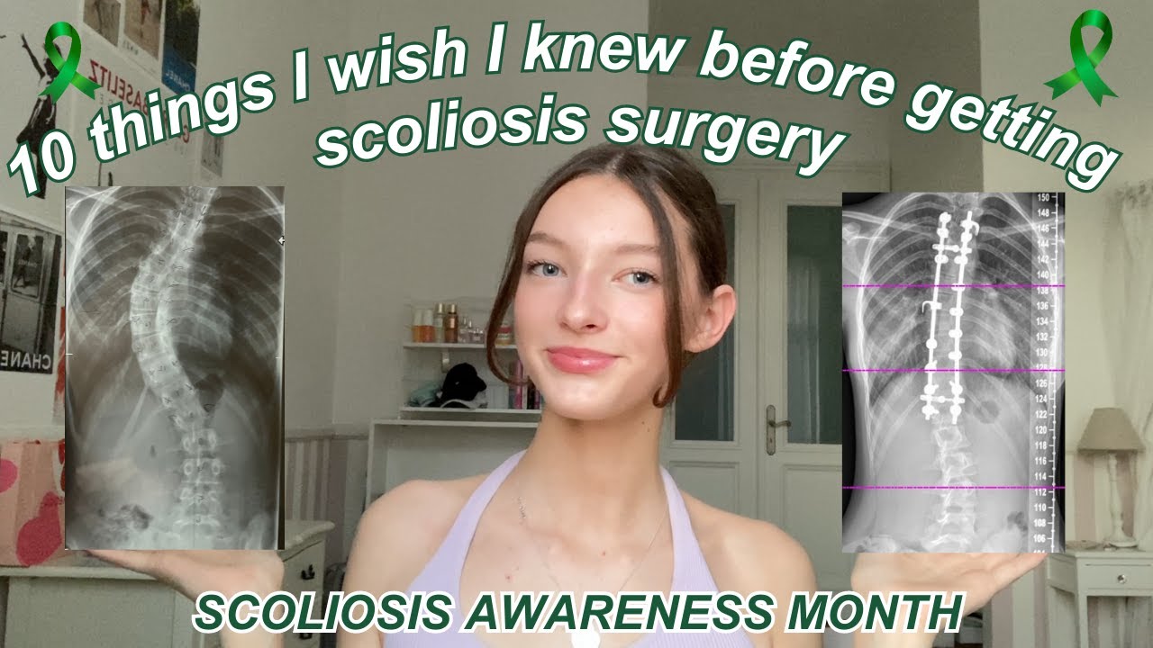 10 things I wish I knew before getting scoliosis surgery