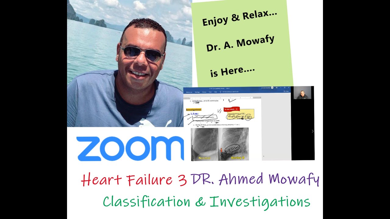 Heart failure lecture 3 classification & Investigations Dr. Ahmed Mowafy شرح مرض القلب   د. موافي