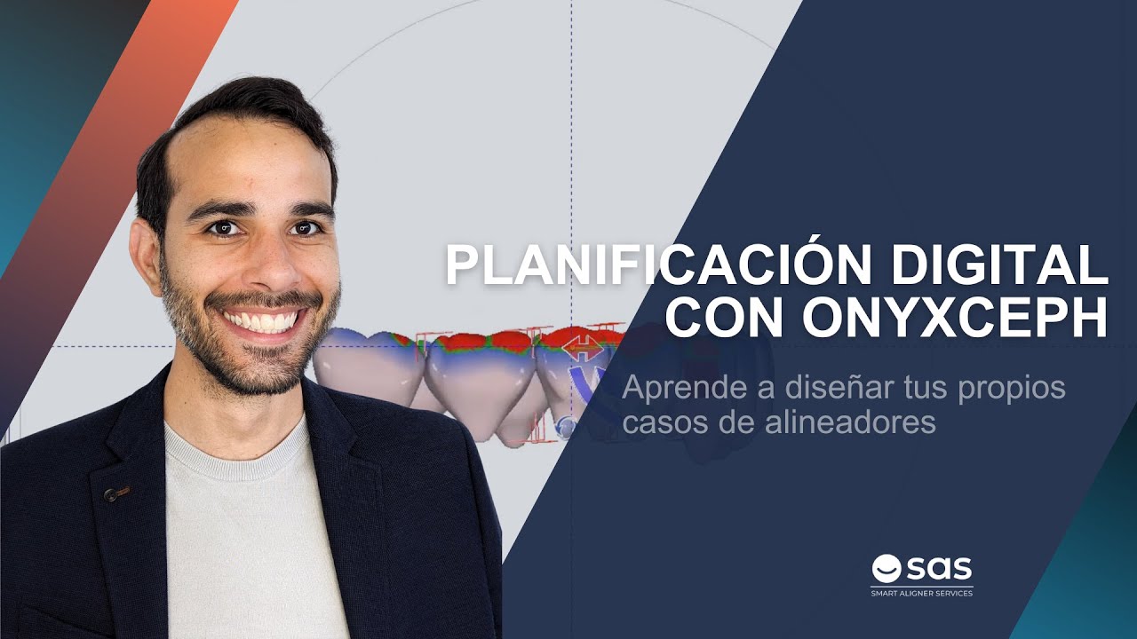Planificaci&oacute;n digital con Onyxceph: Aprende a dise&ntilde;ar tus propios casos de alineadores