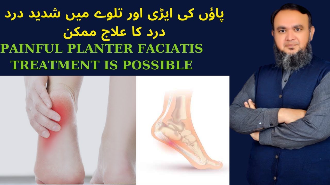 Planter Faciatis | پاؤں کی ایڑی اور تلوے میں شدید درد اور درد کا علاج