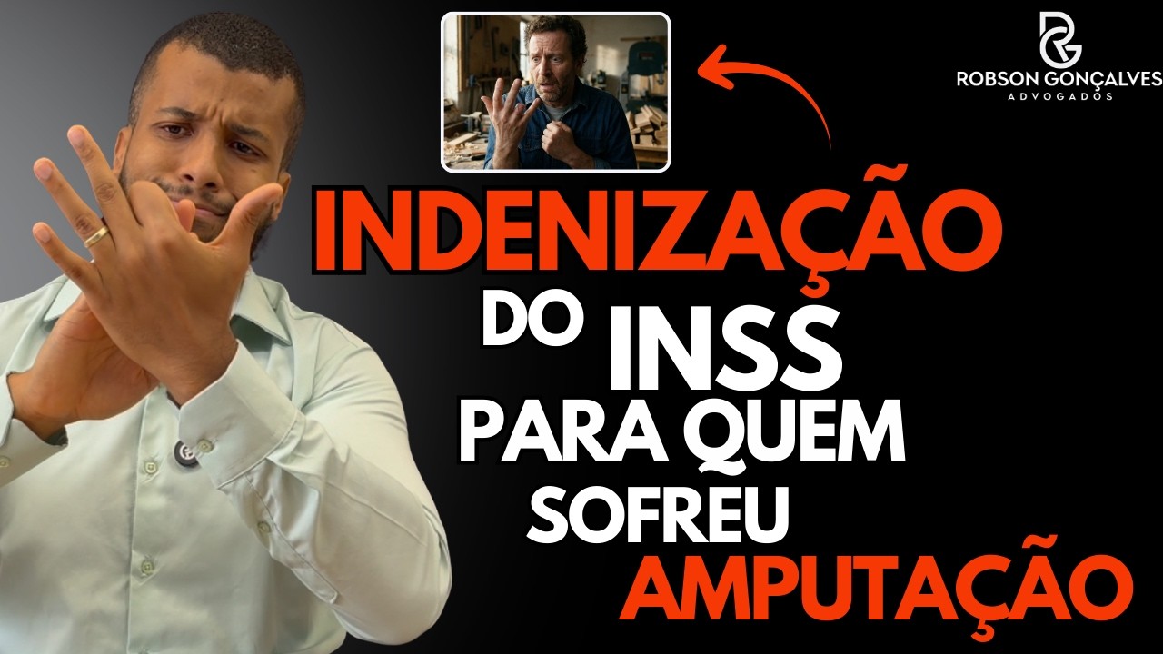 Amputação dá direito a indenização do INSS