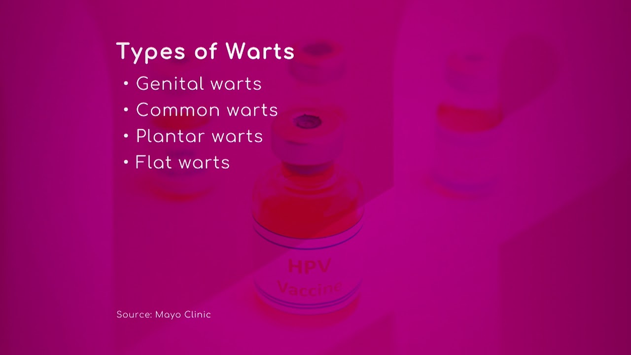 HPV: Types of Warts
