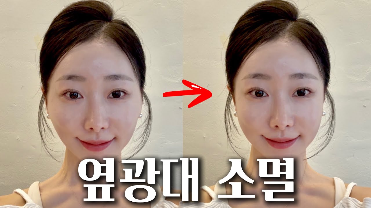 100% 직접 효과 봤던! 옆광대 작아지는 마사지💆🏻&zwj;♀️