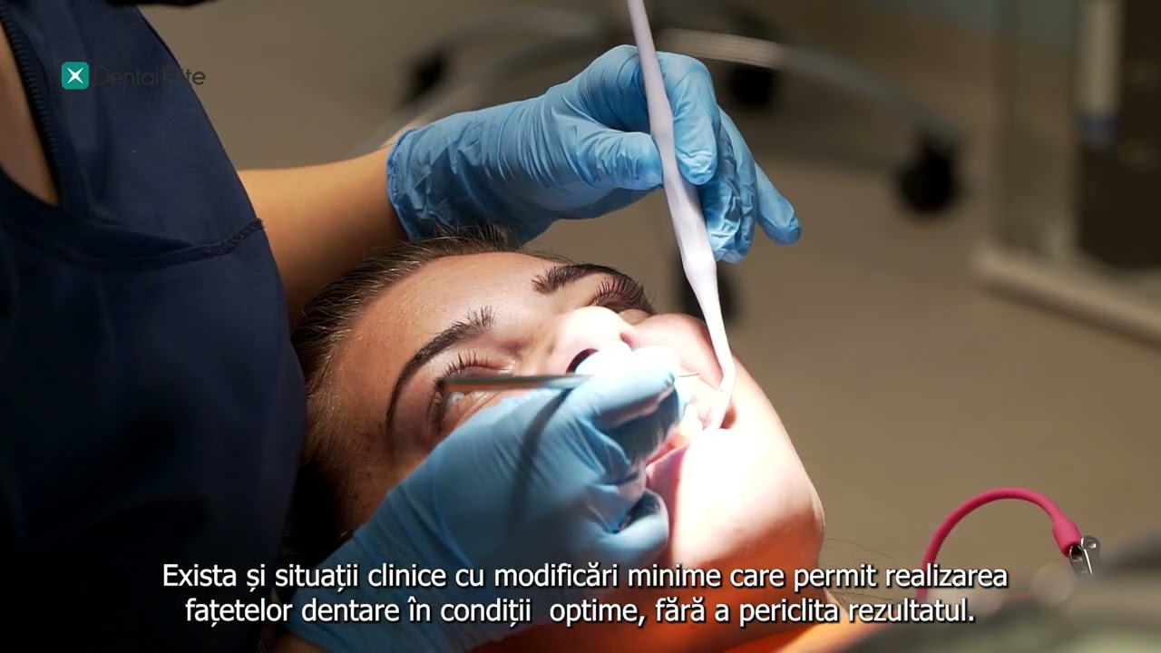 Fațetele Dentare cu Dr. Anca Voiculescu