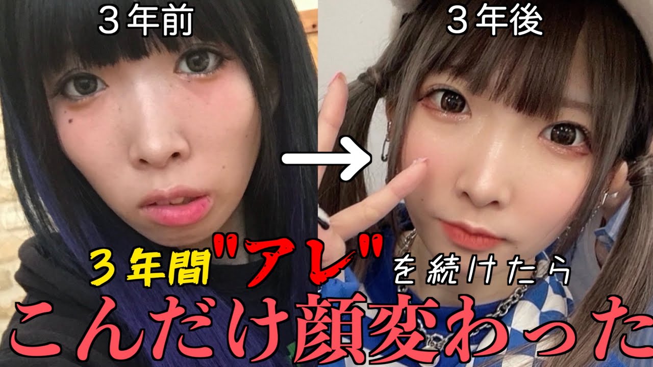 【やってよかった】あれから3年…ブスが教える最強の垢抜け方法はこれじゃ！！！！【口元改善】