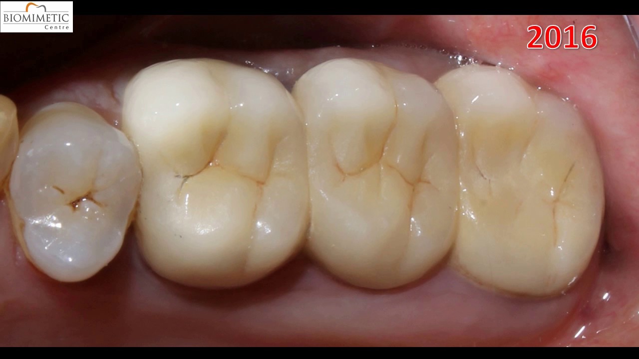 Biomimetic dentistry