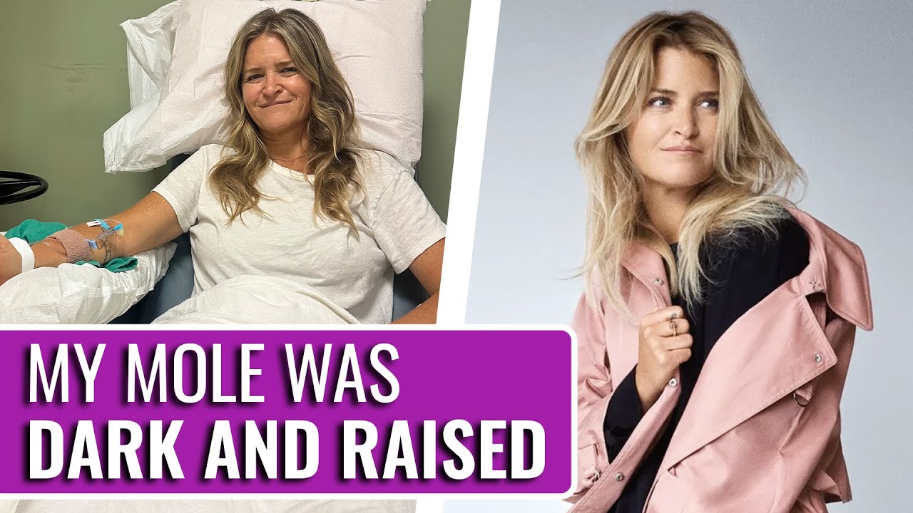 It Started With A Mole On My Back! - Cheyenne | Stage 3B Melanoma | The Patient Story