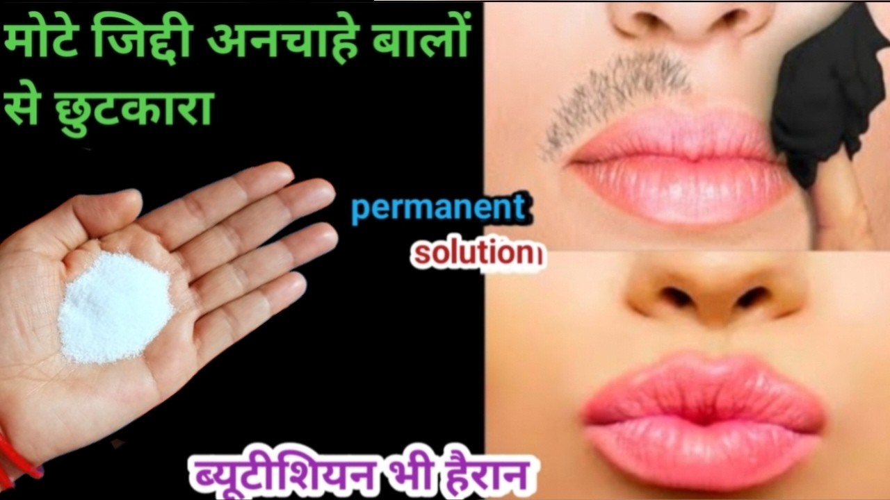 बेसन और कच्चे दूध में सिर्फ एक चीज🤔चेहरे के बाल ऐसे हटा दो मिनट में 😱रिजल्ट ।। unwanted facial hair