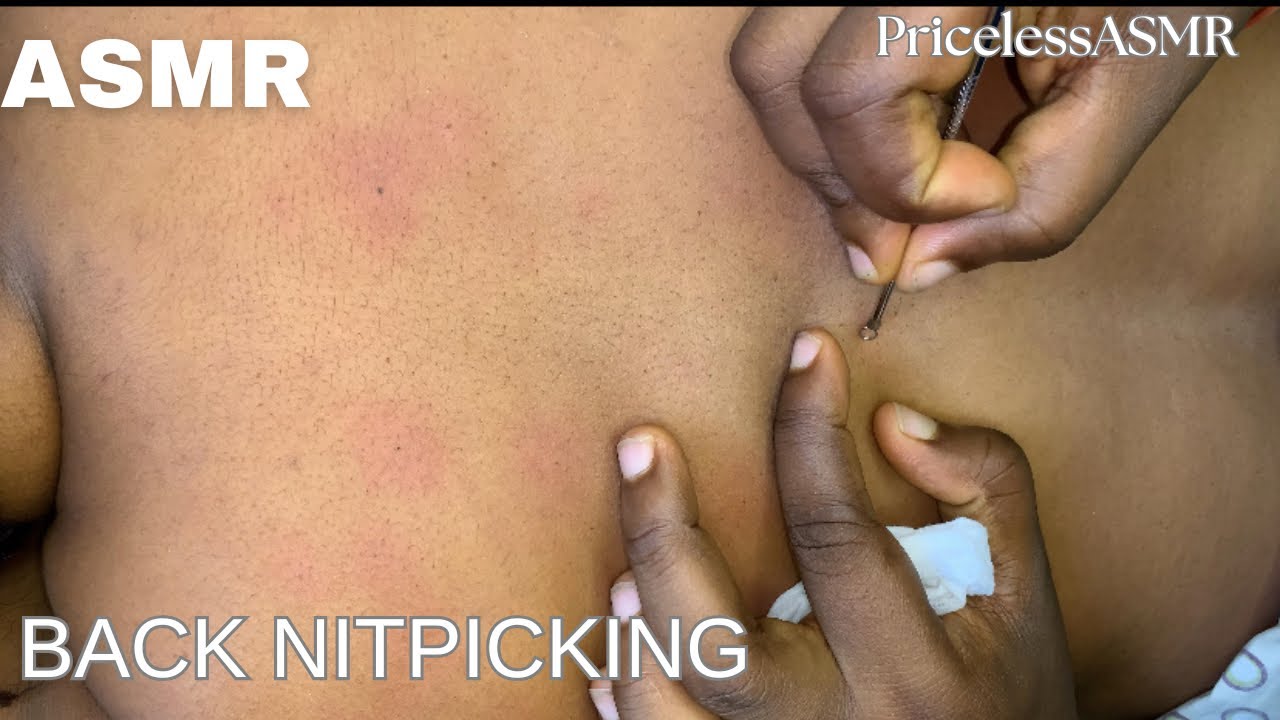 ASMR Back Nitpicking with Relaxing Ambience for Deep Sleep
