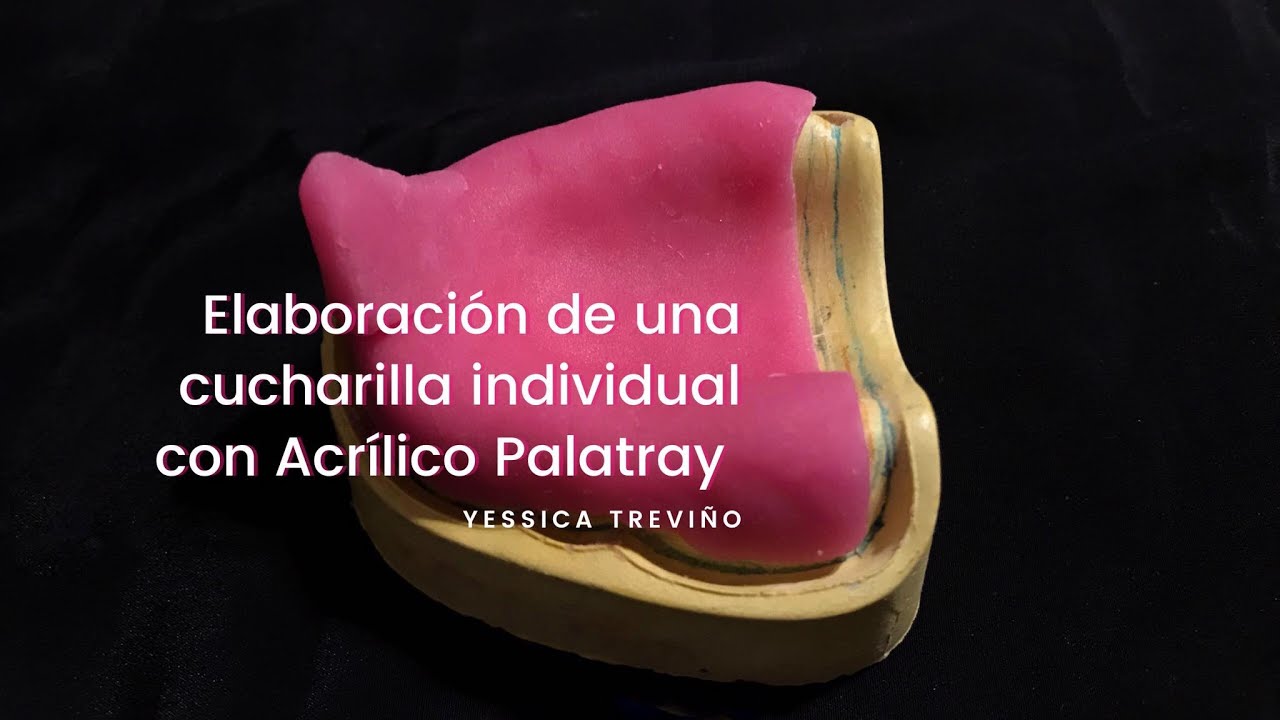 Elaboración de una cucharilla individual con Resina Acrílica Palatray