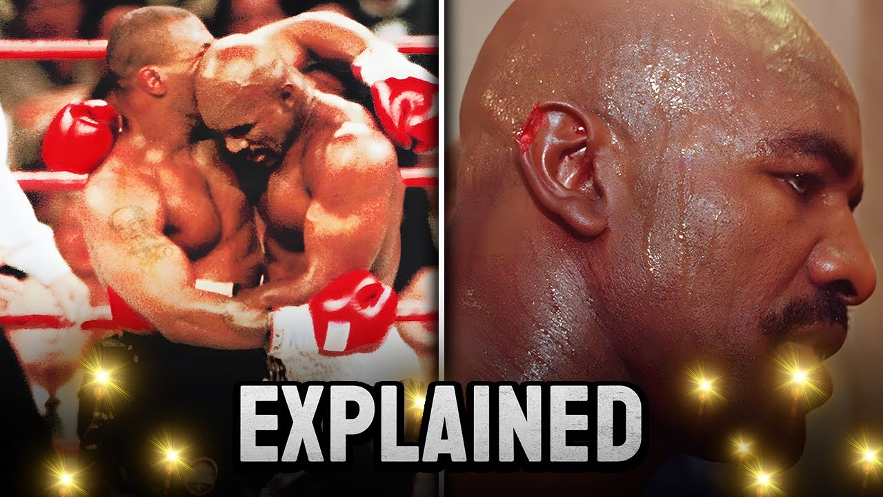 Why Mike Tyson Bit This Fighter&lsquo;s Ear Off &hellip; TWICE - (Evander Holyfield vs Mike Tyson)