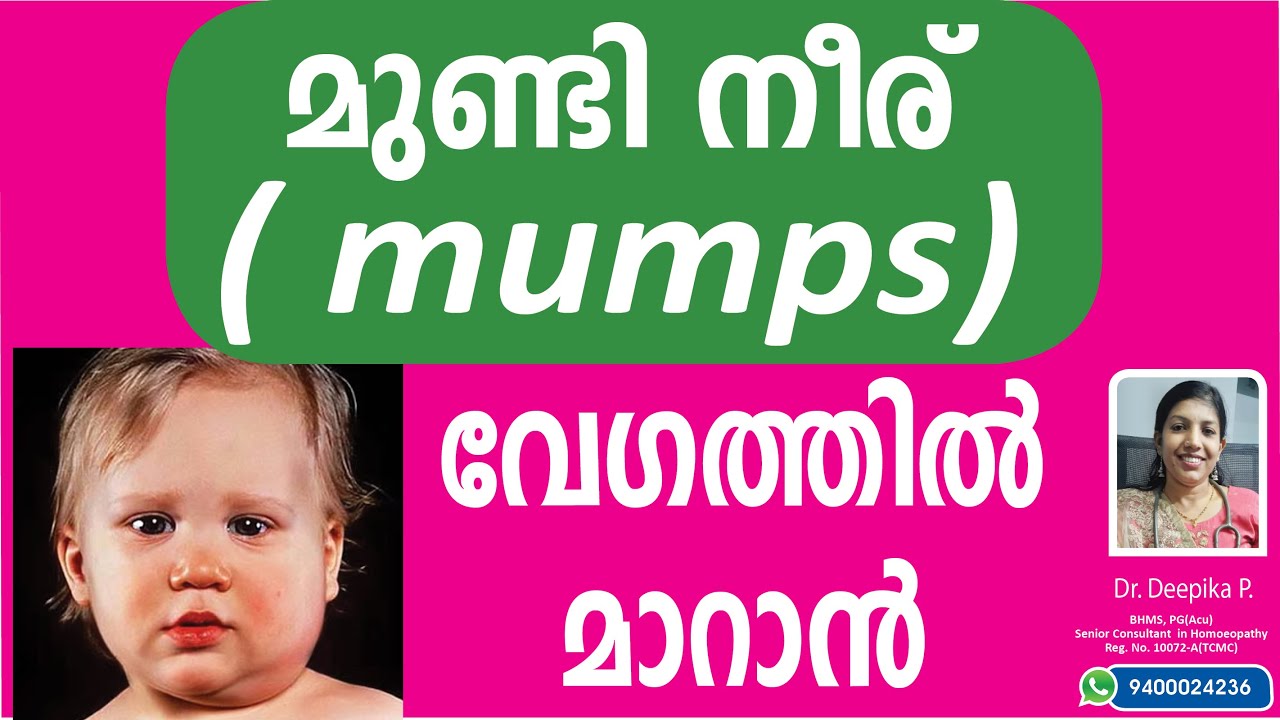 മുണ്ടി നീര് വേഗം മാറാനും വരാതിരിക്കാനും ചെയ്യേണ്ട കാര്യങ്ങൾ | Mundineeru malayalam | mumps malayalam