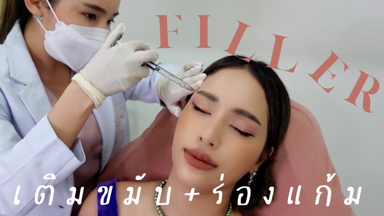 ฟิลเลอร์ขมับ + ร่องแก้ม ดูเด็กลง ละมุนลบโหนก | mossster
