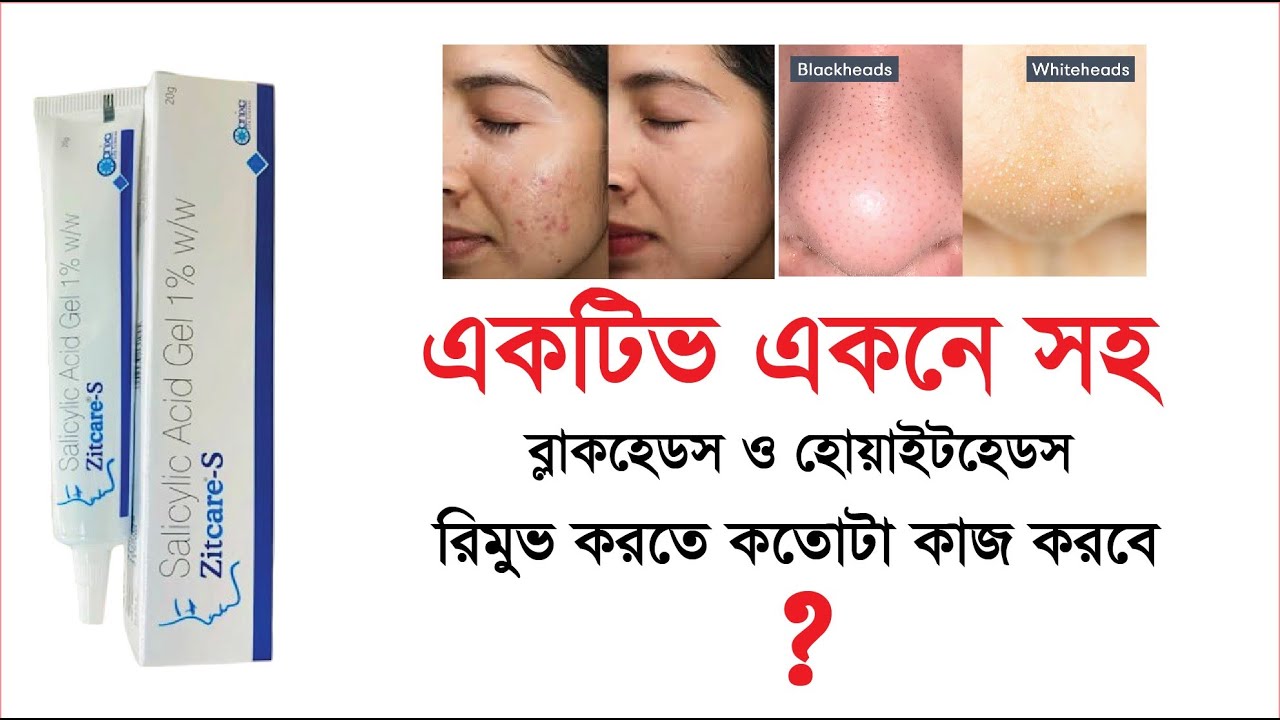 ব্রণ দূর করার ভালো একটি উপায়  Zitcare S Cream Review For Bangladeshi Skin