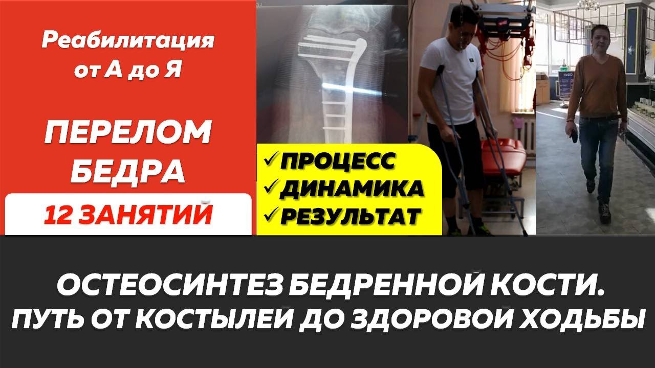 Сложный перелом бедра. Остеосинтез. Реабилитация после перелома и операции. Кинезиотерапия