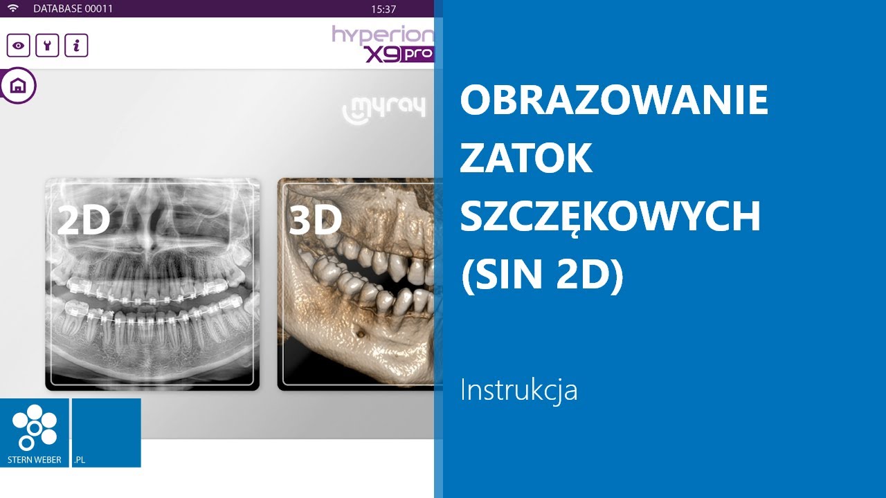 Obrazowanie zatok szczękowych (SIN 2D) | Instrukcja wykonywania badania w MyRay Hyperion X9