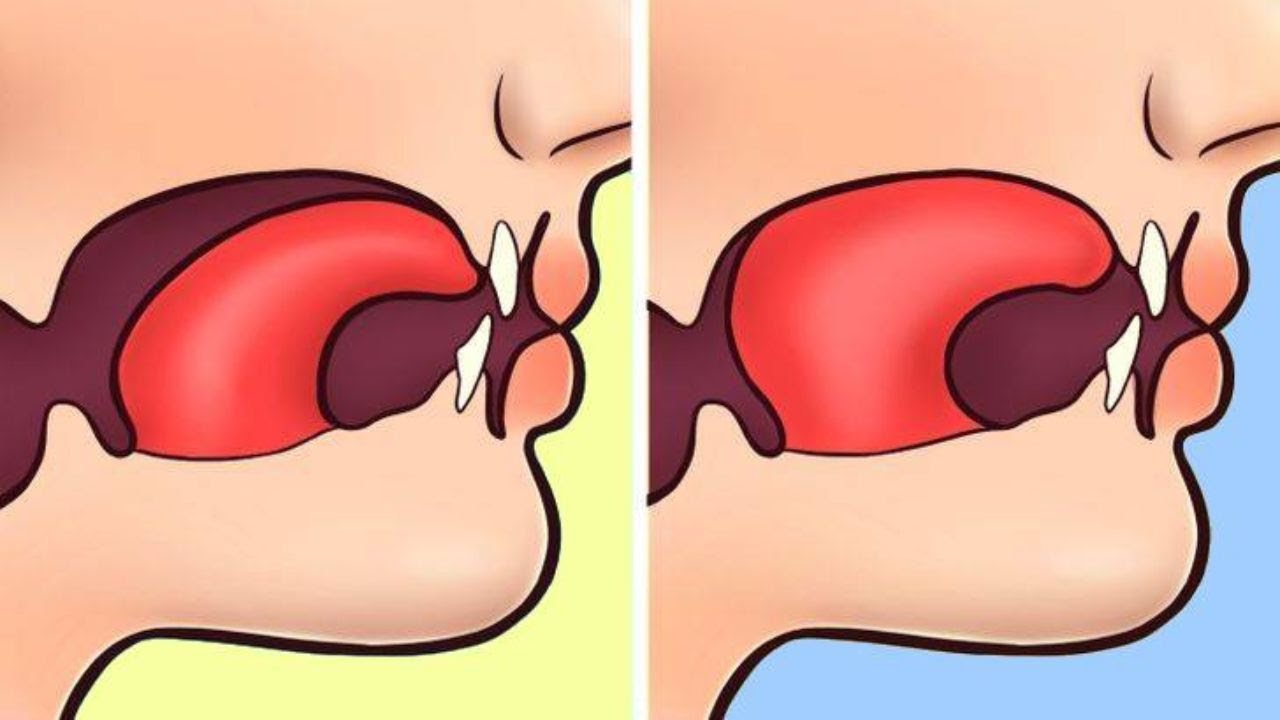 The Complete Mewing Tutorial (Nose Breathing + Tongue Posture)