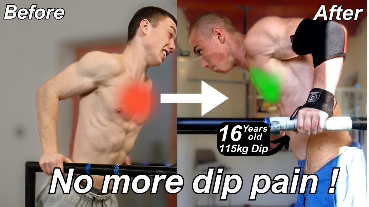 How I Fixed Sternum Pain from Weighted Dips (3 Steps That Actually Work)