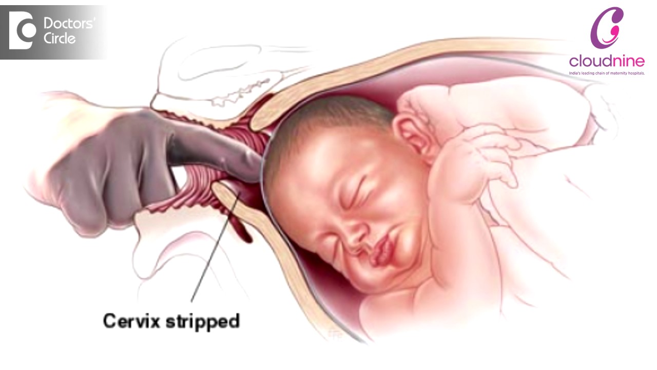 Methods of Labour Induction - Dr. Padmini Isaac | Cloudnine Hospitals