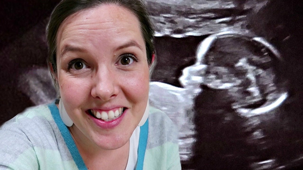 🍼We Find Out BABY GENDER👶🏻