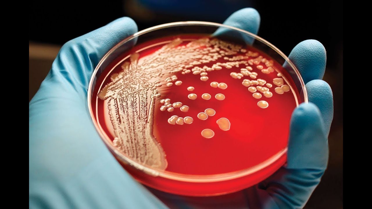 Cleanroom detectives - what microbes can tell us
