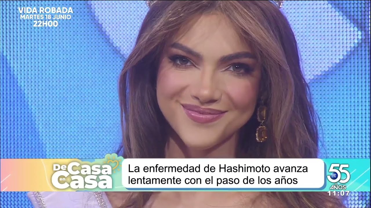 ¿Cómo cambió la vida de Mara Topic al ser diagnosticada con el síndrome de Hashimoto?