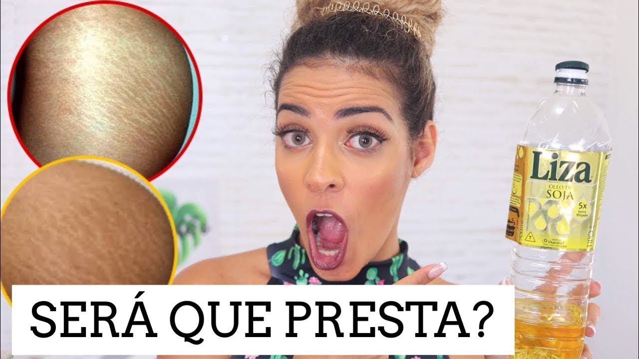 COMO eliminar ESTRIAS em casa (EM 3 DIAS)  #SERAQUEPRESTA ? @Faladantas  oleo de cozinha nas estrias