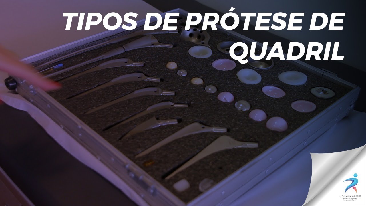 Tipos de prótese de quadril