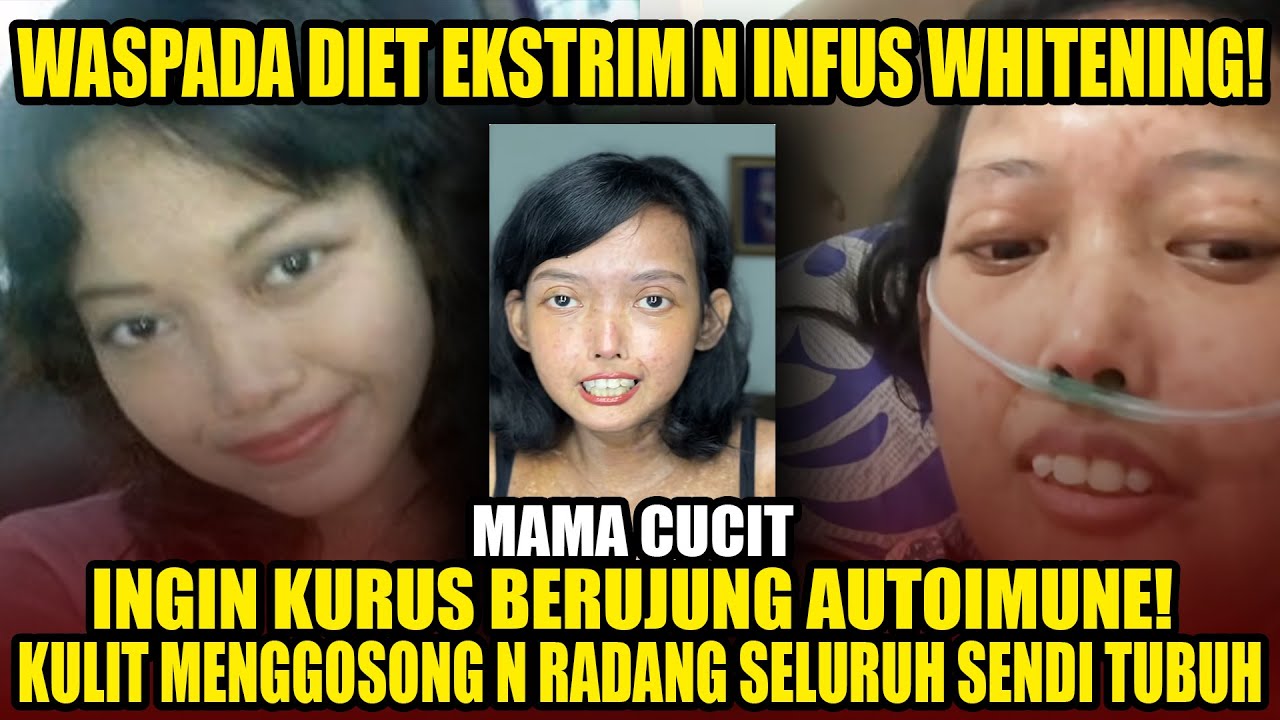 DIET EKSTREM BERAKHIR AUTOIMUN!!HARUS NONTON!!