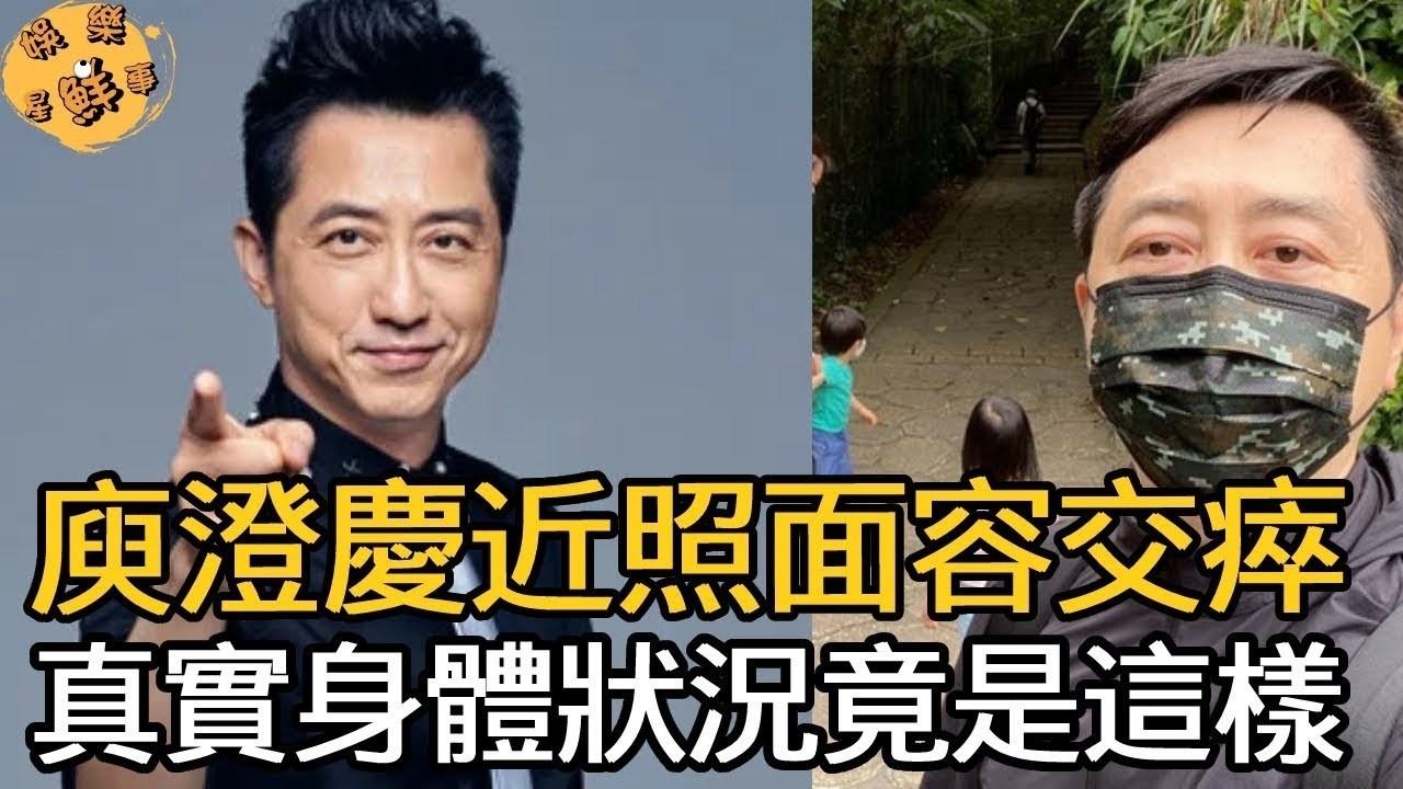庾澄慶近況曝光面容交瘁，經紀人說出他真實身體狀況，一代天王竟至如此【娛樂星鮮事】#庾澄慶