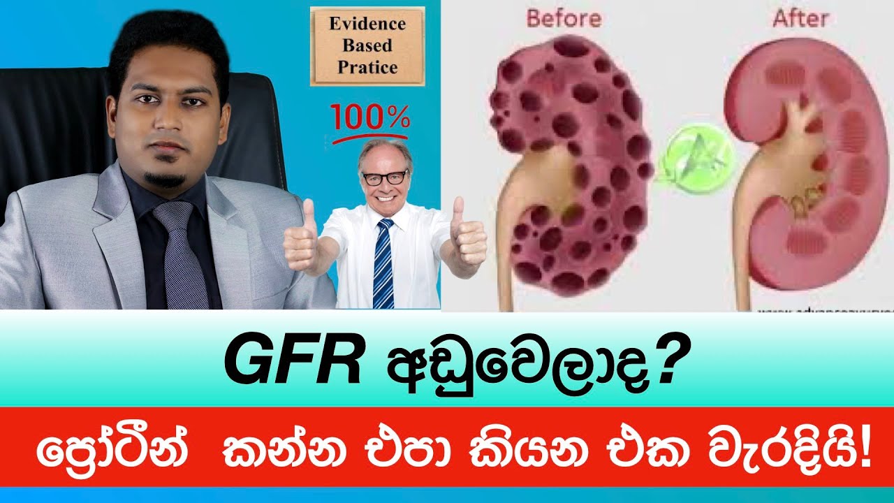 GFR අඩුවෙලාද?  වැඩි කරගන්නේ කොහොමද? GFR By Nutritionist Hiroshan Jayaranga