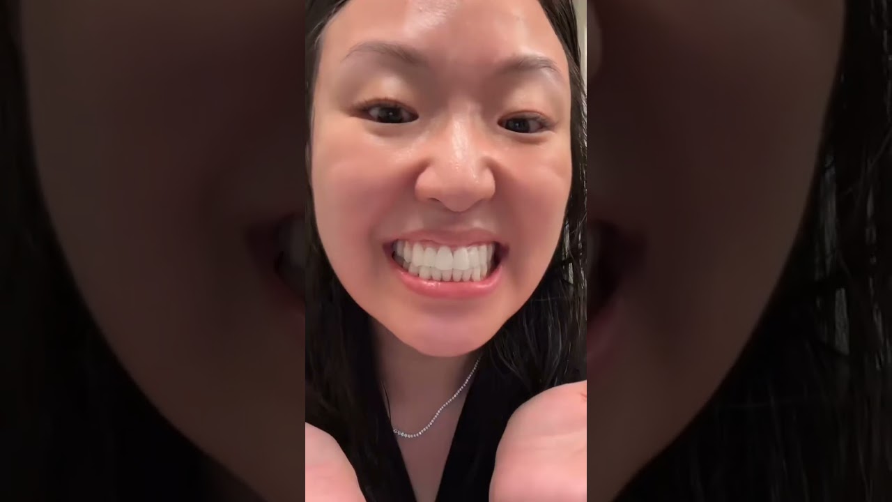 ✨ Crest 3D Whitestrips &ndash; Pro Teeth Whitening Kit at Home 😁
