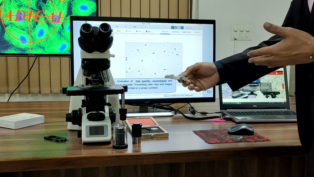 CASA Computer Assisted Sperm Analysis