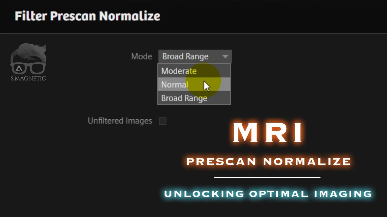 MRI – PRESCAN NORMALIZE : UNLOCKING OPTIMAL IMAGING