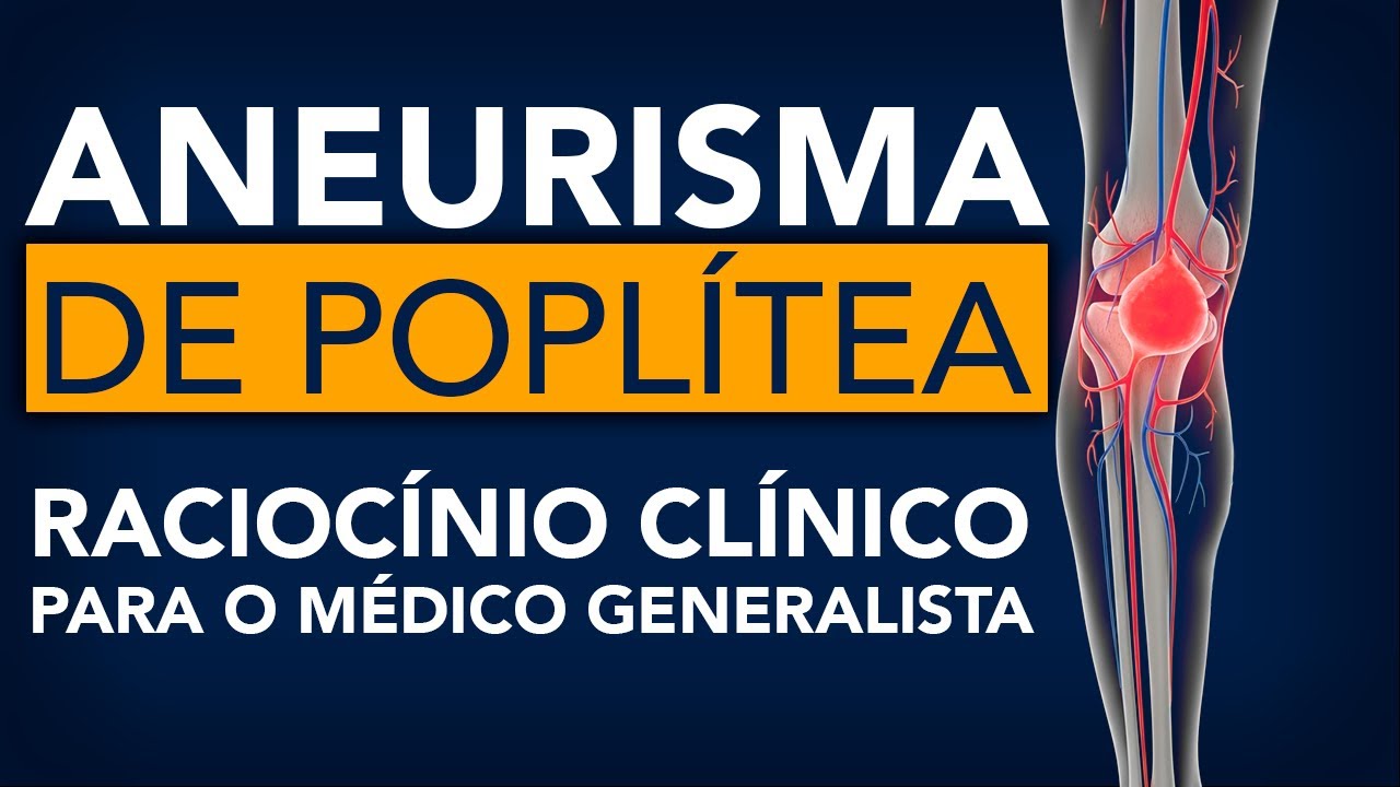 Aneurisma de poplítea - Raciocínio clínico para o médico generalista