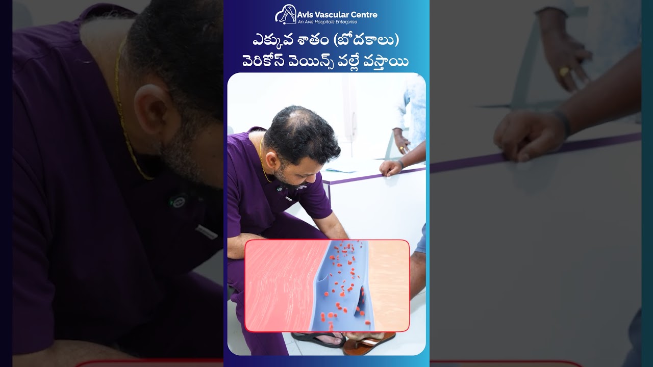 Most Cases of Elephantiasis Are Linked to Varicose Veins | Know the Truth | Avis Hospitals