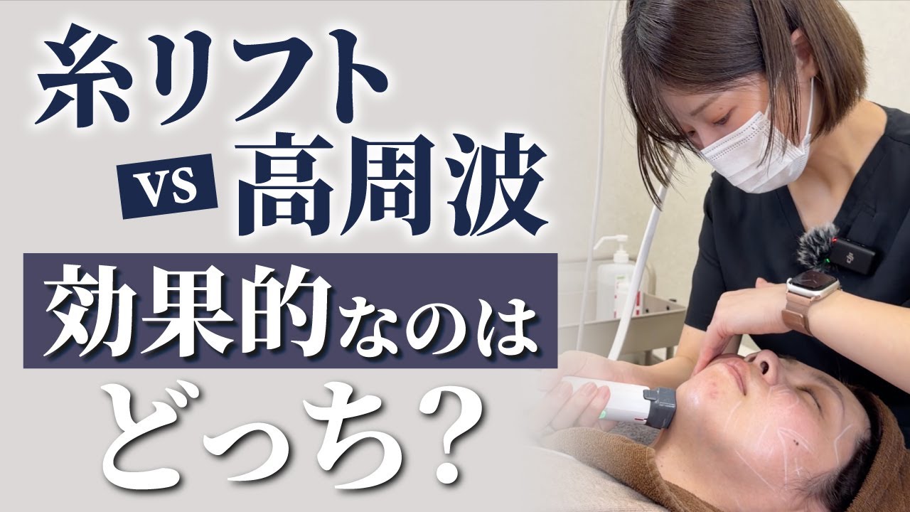 チークトップをあげたい！高周波VS糸リフトどっちがいい？