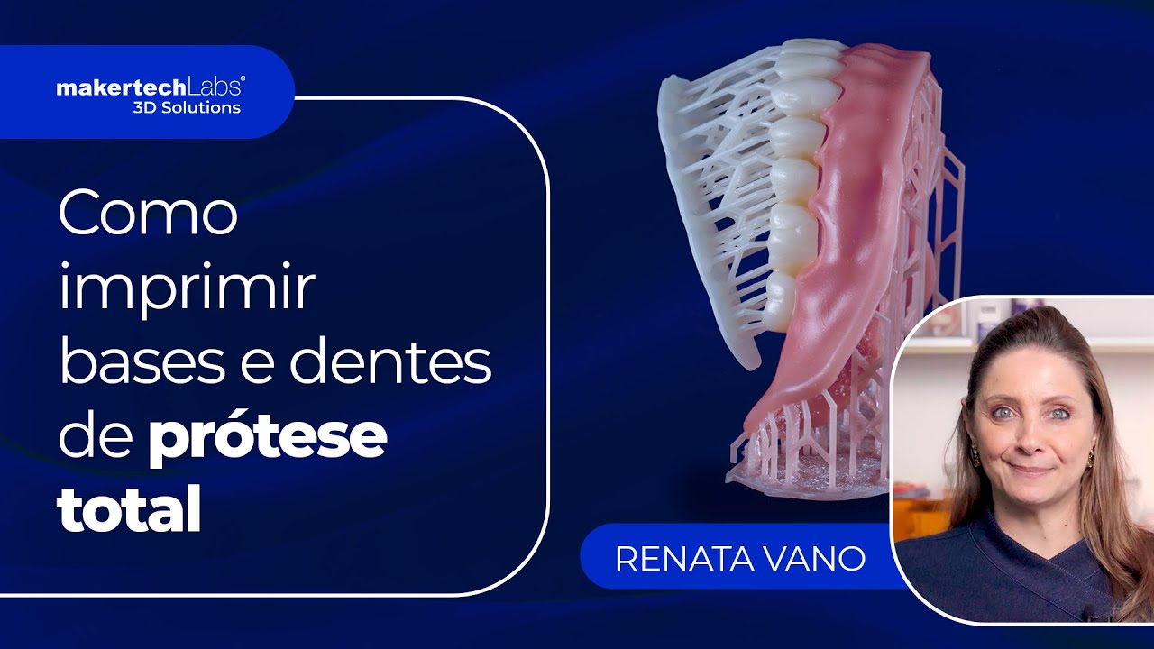Prótese Total Impressa em 3D – Como Imprimir Bases e Dentes com Renata Vano!