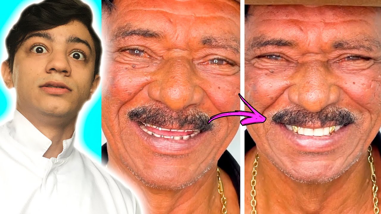 DENTISTA REAGE - TIRINGA E O SORRISO DE OURO