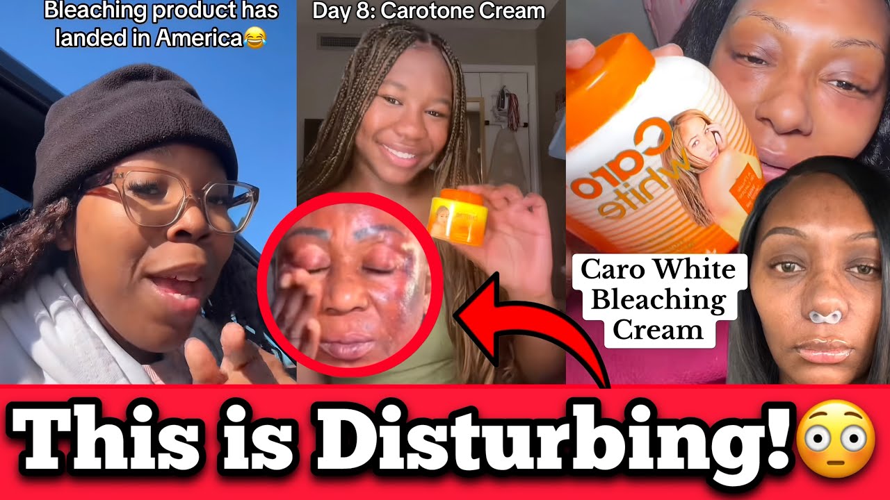 Южноафриканцы реагируют на то, что американцы открыли для себя отбеливающий крем Carolight
