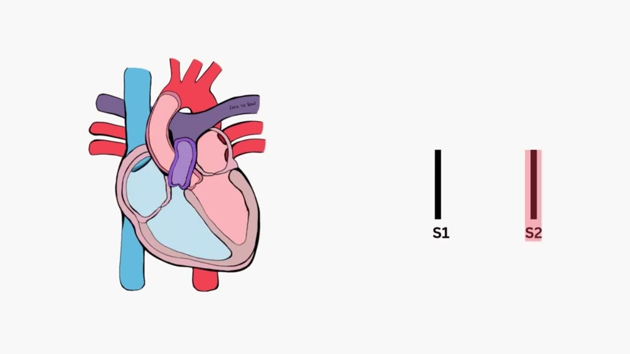 Heart sound Overview  By Zero to goal