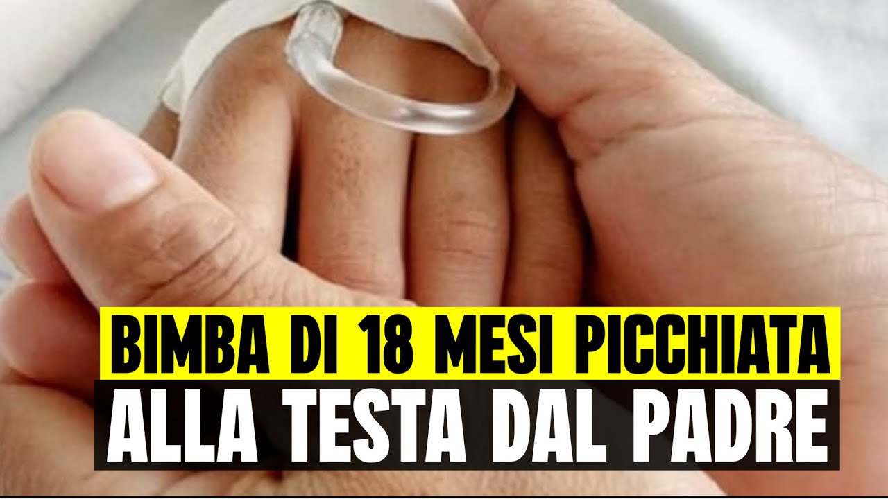 ORRORE A RIMINI: BIMBA DI 18 MESI IN OSPEDALE PER LE BOTTE ALLA TESTA DEL PADRE