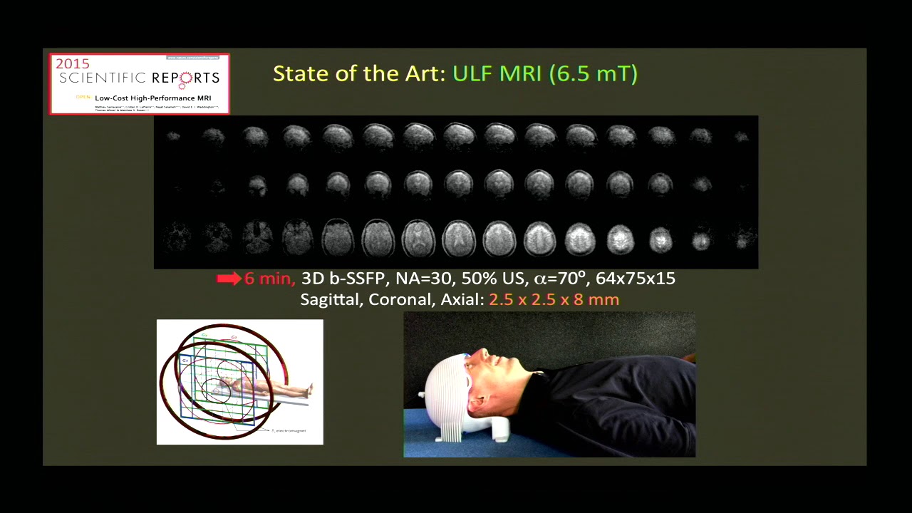 9th Annual TMII Symposium - 2019 - Session III - Neuroimaging - Matthew Rosen, PhD
