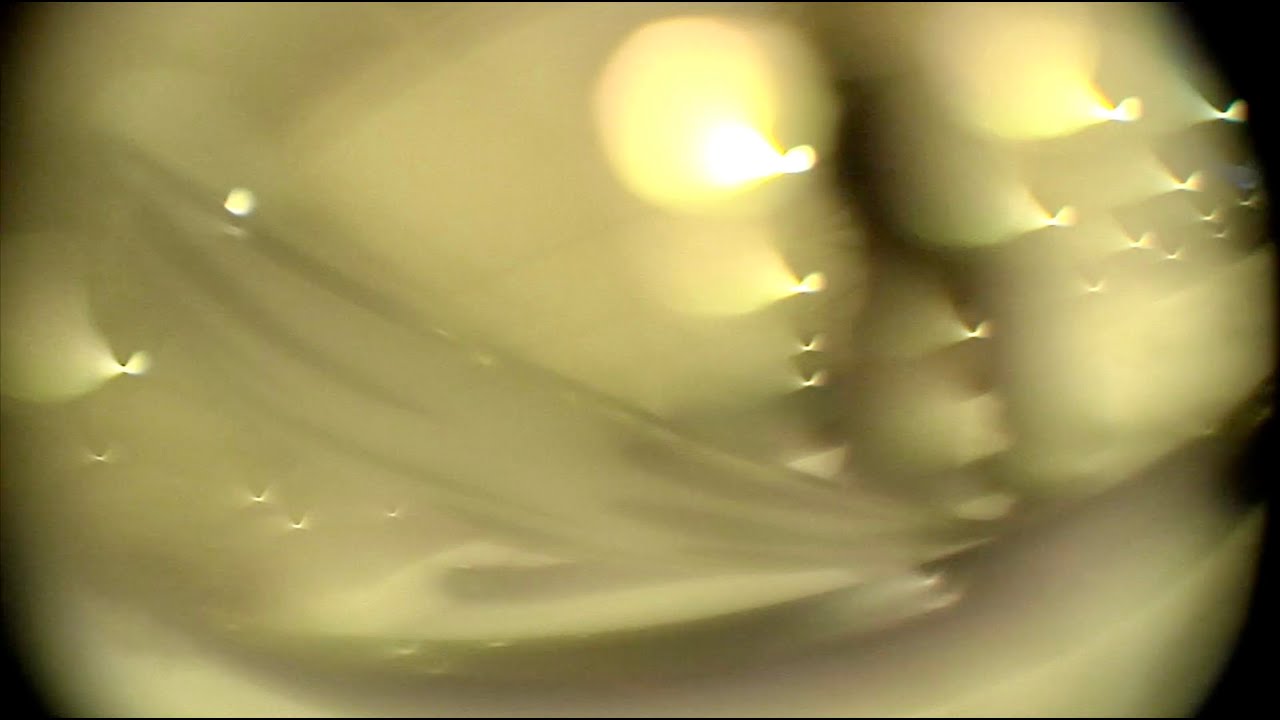 [SNOW]