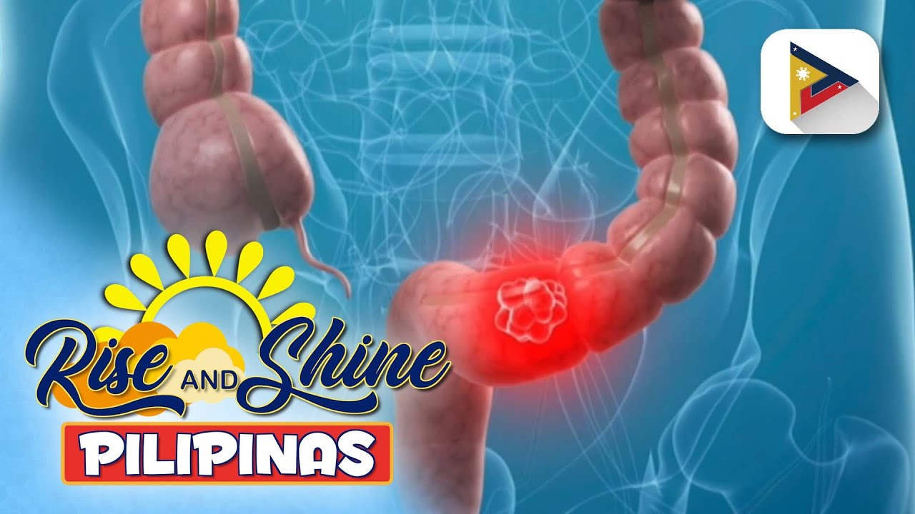 Say ni Dok | Tips para mapanatiling healthy ang iyong colon