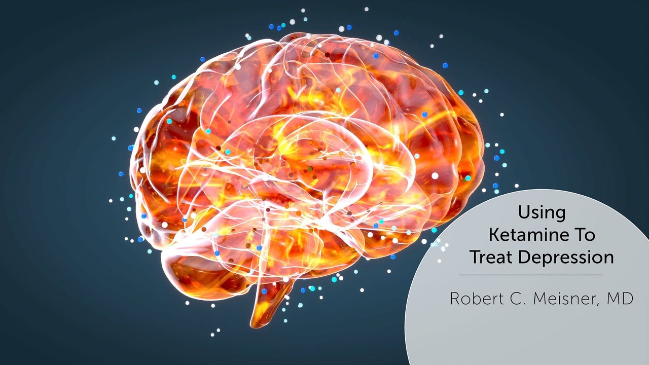 Using Ketamine To Treat Depression