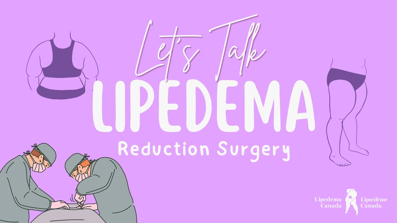 Lipedema Canada - Let's Talk Lipedema Reduction Surgery
