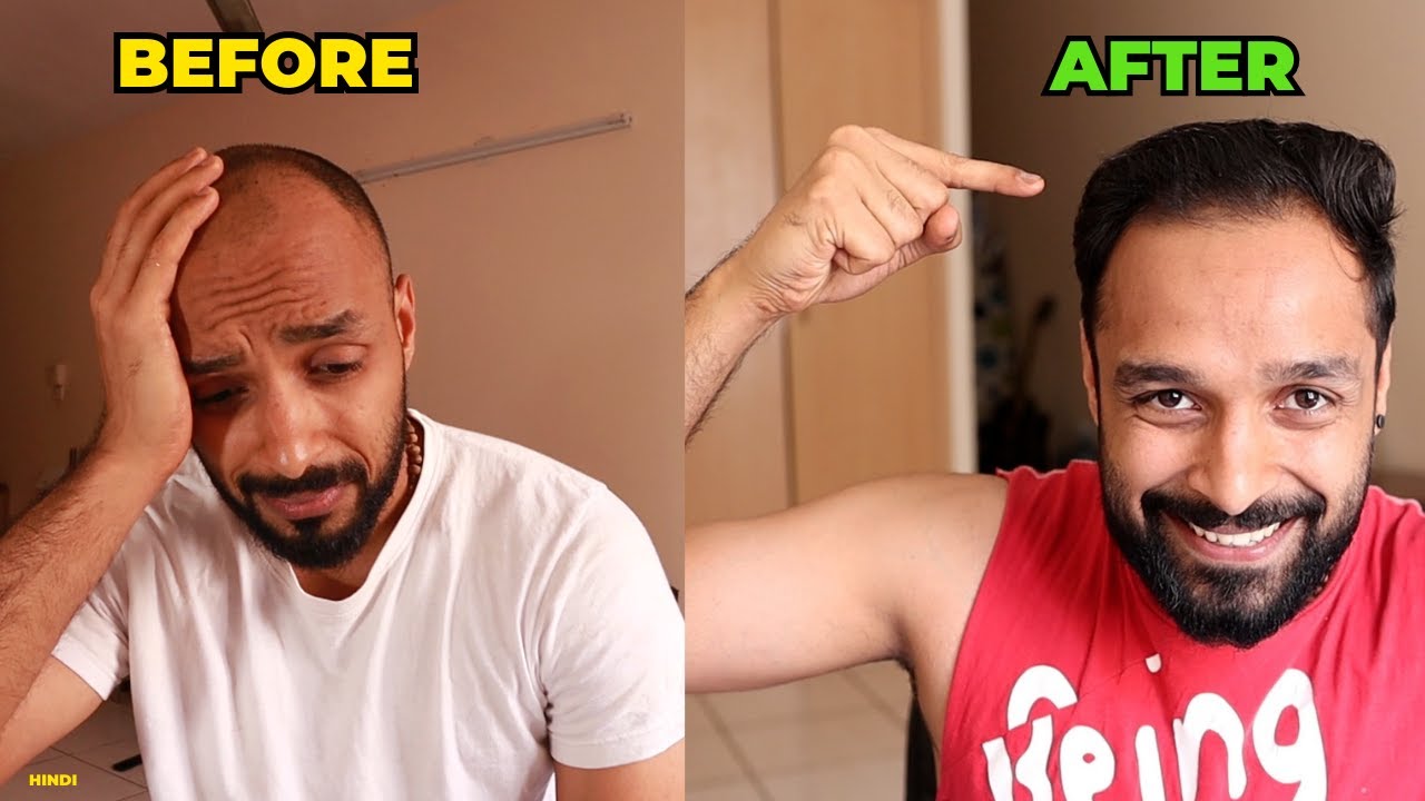 ✅ DAILY HAIR CARE ROUTINE : To Prevent Hair Loss 👨‍🦲