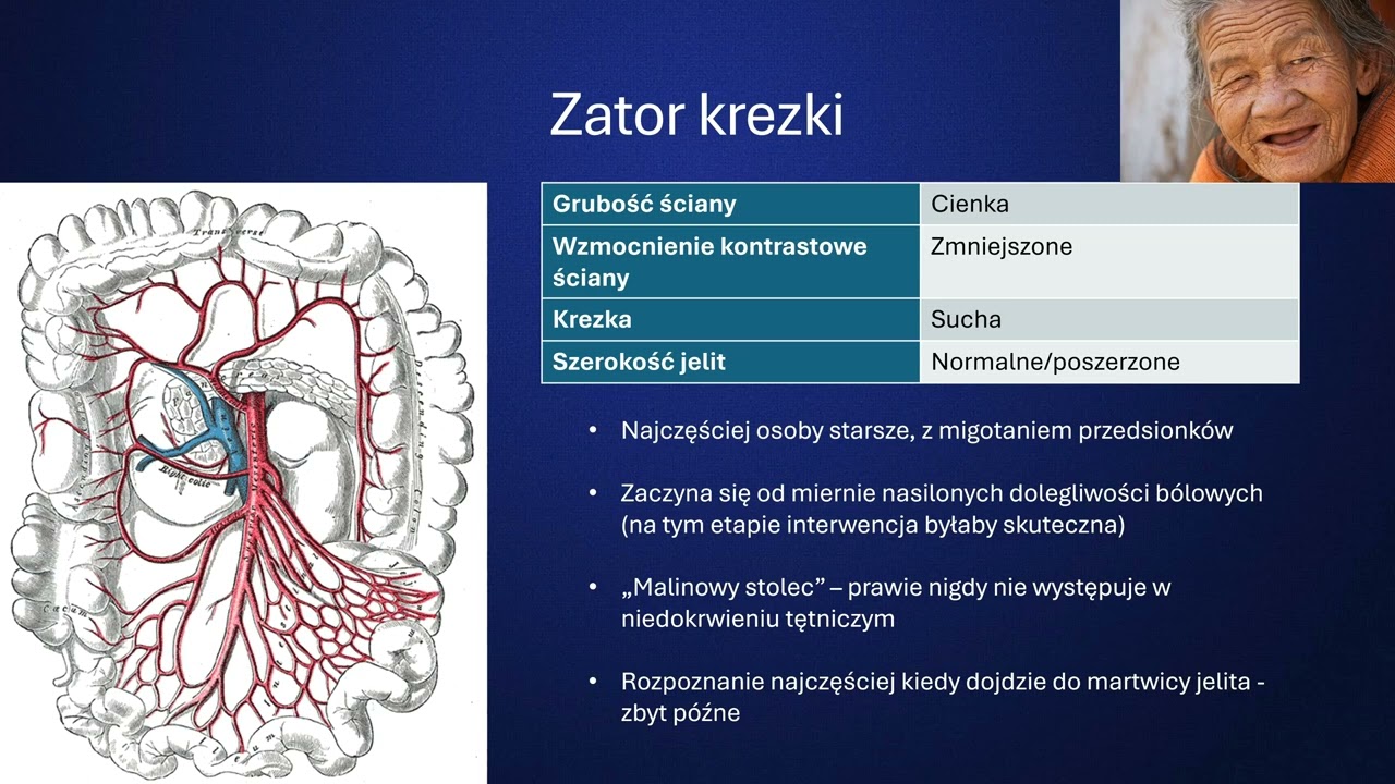 M. Frączek - Diagnostyka stanów nagłych w jamie brzusznej
